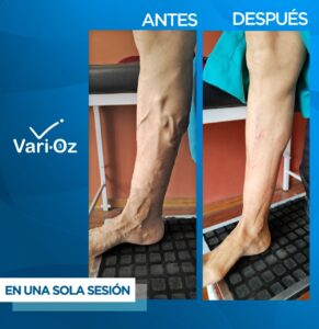 varioz3